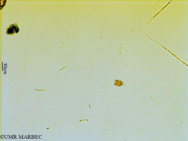 phyto/Scattered_Islands/all/COMMA April 2011/Nanoflagellé 10 (ancien Flagellé 6)(copy).jpg
